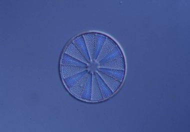 Mikroskop altında denizden gelen diatomlar 100x