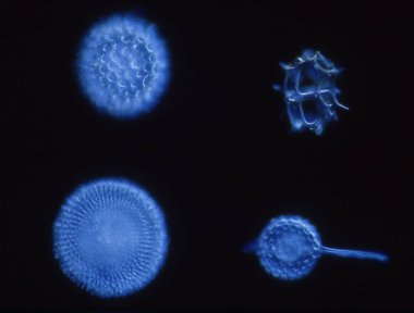 Kieselalgen aus dem Meer unter dem Mikroskop 100x