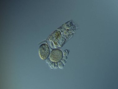 Rotiferler mikroskop altında suda yüzerler.