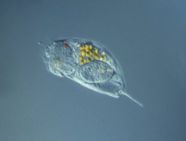 Rotiferler mikroskop altında suda yüzerler.