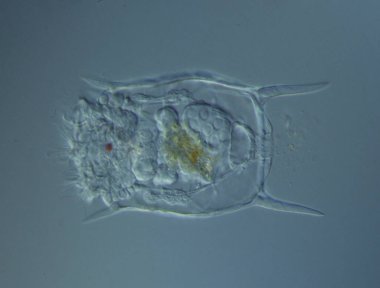 Rotiferler mikroskop altında suda yüzerler.