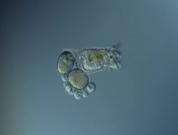 Rotifers Swim Water Microscope — Stock Photo, Image