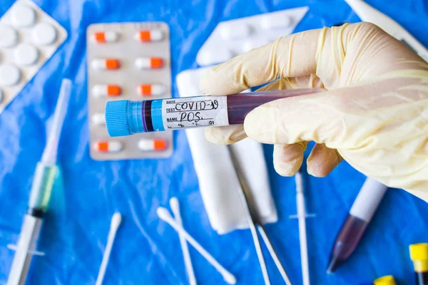 コロナウイルス検査サンプル 診断と実験室 スタジオ撮影 白の背景 — ストック写真