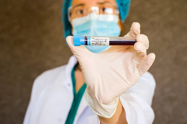 Corona Virus Positive Test Samples Diagnosis Laboratory Doctors Head Hand — Stock Photo, Image