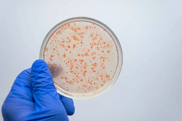 Bilimadamı Bağırsakların Mikrobiyotasını Inceliyor — Stok fotoğraf