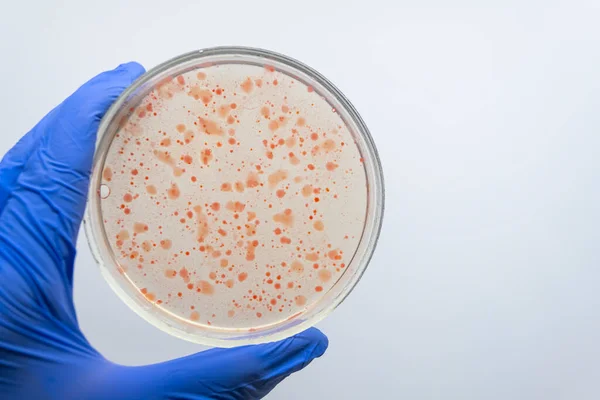 Scientist Hand Holding Petri Dish Colonies Red Bacteria — Stock Photo, Image