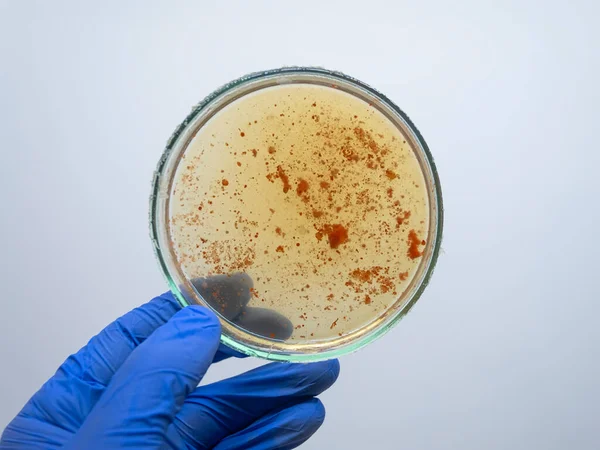 Scientist Analyzes Red Colonies Bacteria — Stock Photo, Image