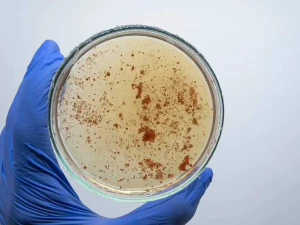 Czerwone Bakterie Bliska — Zdjęcie stockowe
