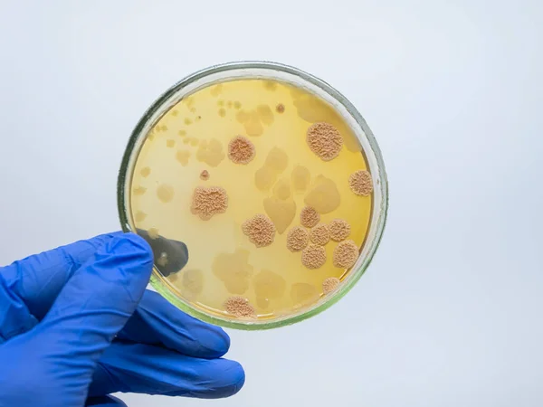 Hand Holding Petri Dish Colonies — Stock Photo, Image