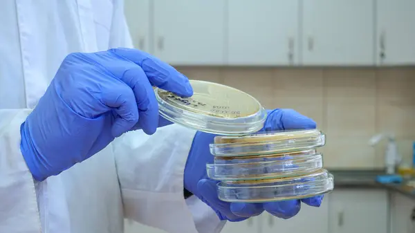 Ученый Синих Перчатках Берет Чашку Петри Бактериями — стоковое фото