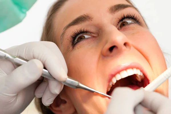 歯医者 歯科治療症例 — ストック写真