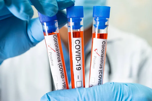 Positive Blood Infection Samples Test Tube Covid Coronavirus Lab Scientist — Stock Photo, Image