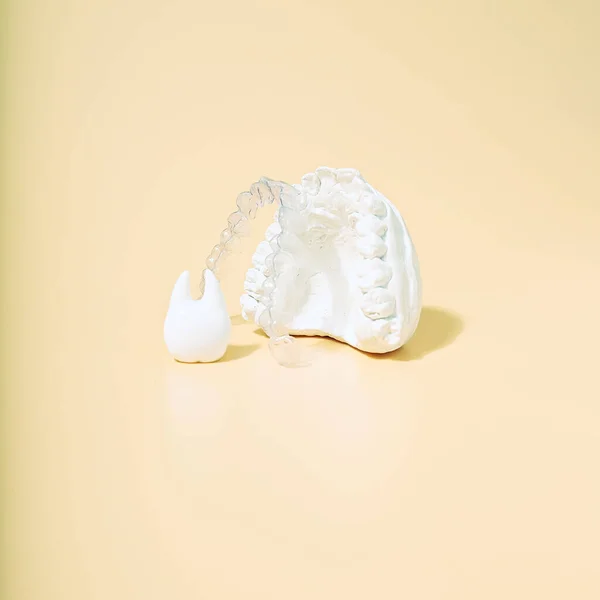 Ortodoncia Tema Dental Sobre Fondo Amarillo — Foto de Stock