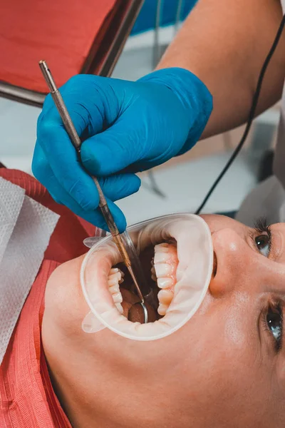 Higiene Oral Uma Mulher Consultório Dentista Uso Retrator Enquanto Escova — Fotografia de Stock