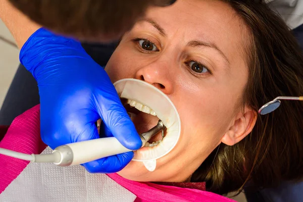 病人和牙医 乳牙检查和治疗 清除旧填充物 使用牵引器 — 图库照片
