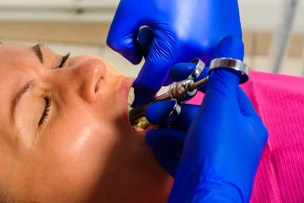 치과의 주사기를 사용하여 잇몸에 마취를 도입한다 — 스톡 사진