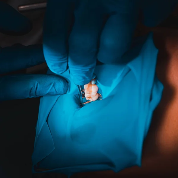 牙医安装橡胶坝 消毒和现代牙科治疗 — 图库照片