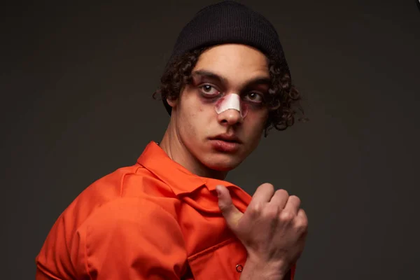 Uomo Con Naso Rotto Lividi Sotto Gli Occhi Arancione Camicia — Foto Stock