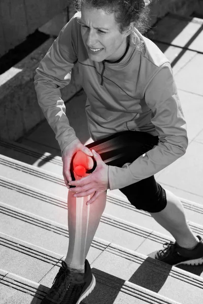 Lesão Joelho Corredor Com Skelethon — Fotografia de Stock