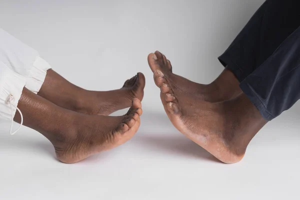 将非裔美国人的腿和腿紧密地联系在一起 将他们隔离在白种人的背景下 以寻求爱情和治疗 — 图库照片