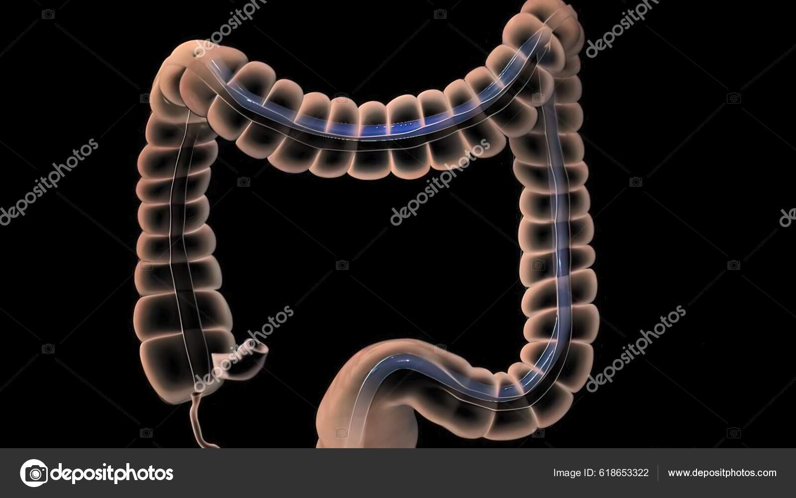 Proctoscopy Vs Colonoscopy