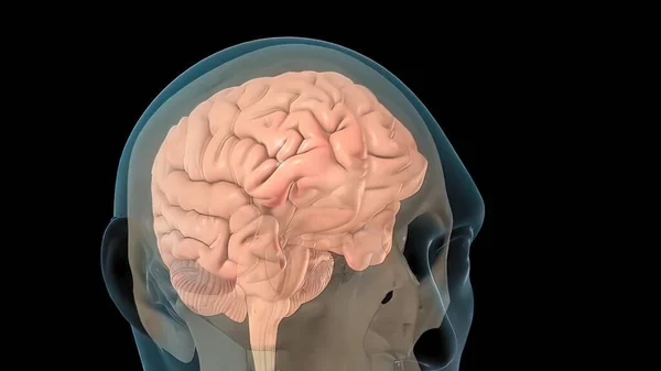Lesión Cerebral Traumática Leve Puede Afectar Sus Células Cerebrales Temporalmente — Foto de Stock