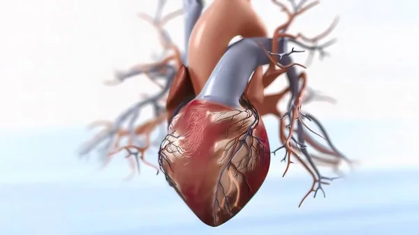 急性冠状动脉综合征3D医学 — 图库照片