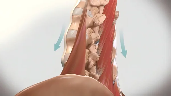 Dolor Lumbar Crónico Dolor Parte Baja Espalda — Foto de Stock
