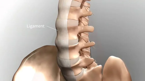Chronische Rückenschmerzen Schmerzen Unteren Rücken — Stockfoto