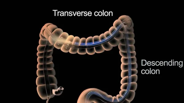 Colonoscopy Visualization Large Intestine Tube Called Colonoscope — Zdjęcie stockowe