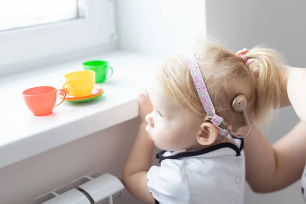 Cochlear Implant Baby Girl Head Hearing Aid Deafness Concept — Stockfoto