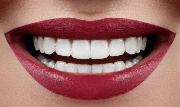 Όμορφο Χαμόγελο Λεύκανση Δοντιών Οδοντιατρική Φωτογραφία Macro Κλείσιμο Του Τέλειου — Φωτογραφία Αρχείου