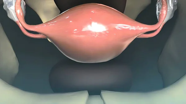 Female Internal Reproductive Organs Vagina Uterus Fallopian Tubes Ovaries — Stock Photo, Image