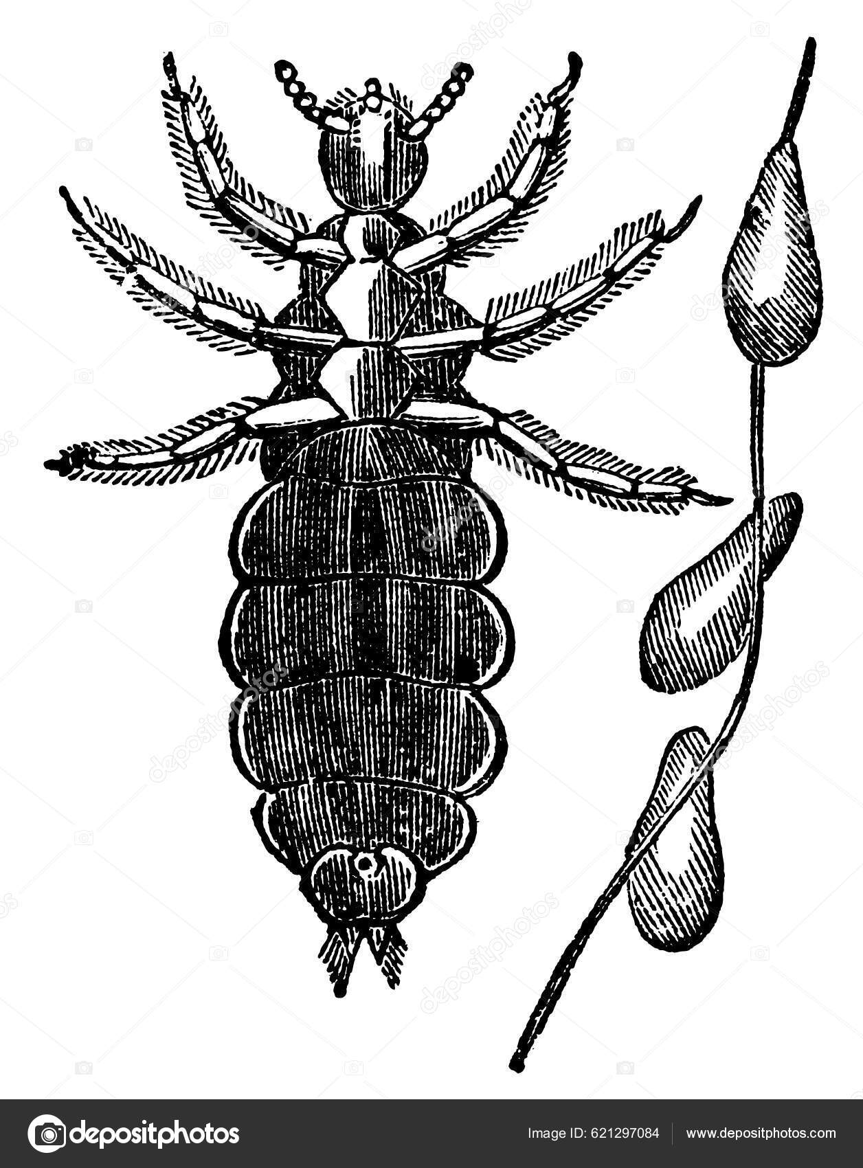 Head Lice Pediculus Humanus Capitis Vintage Engraving Stock Vector Image by ©YAY_Images 621297084