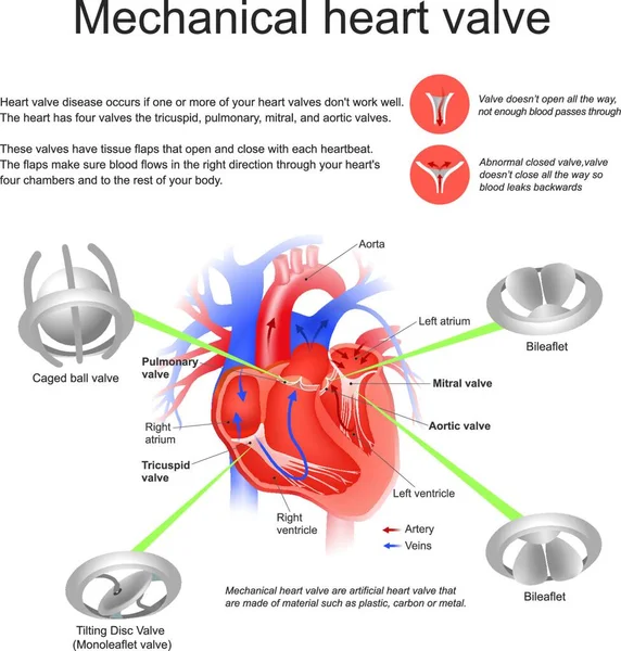 机械心脏瓣膜 矢量图解简单设计 — 图库矢量图片