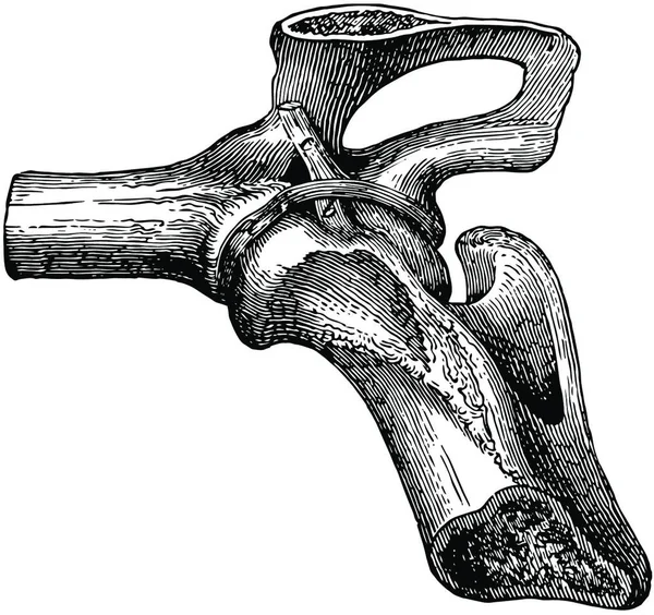 Hip Joint Ligamenten Vintage Vector Illustratie — Stockvector