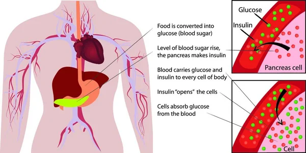Blood Sugar Glucose Absorption Human Body Infographics —  Vetores de Stock