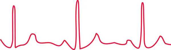 Kardiogramm Auf Weißem Hintergrund — Stockvektor