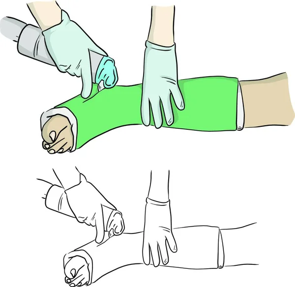 Close Hand Cutting Plaster Cast Leg Foot Patient Vector Illustration — Stock Vector