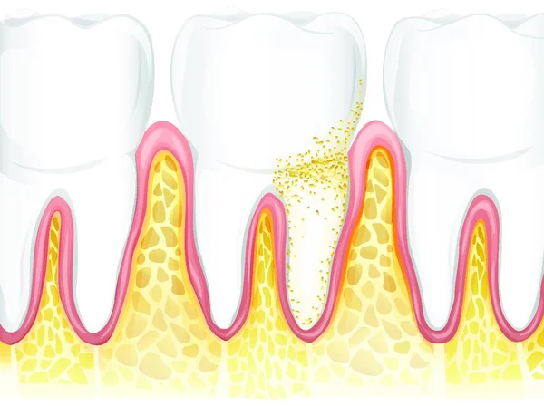 Illustration Teeth — Stock Vector