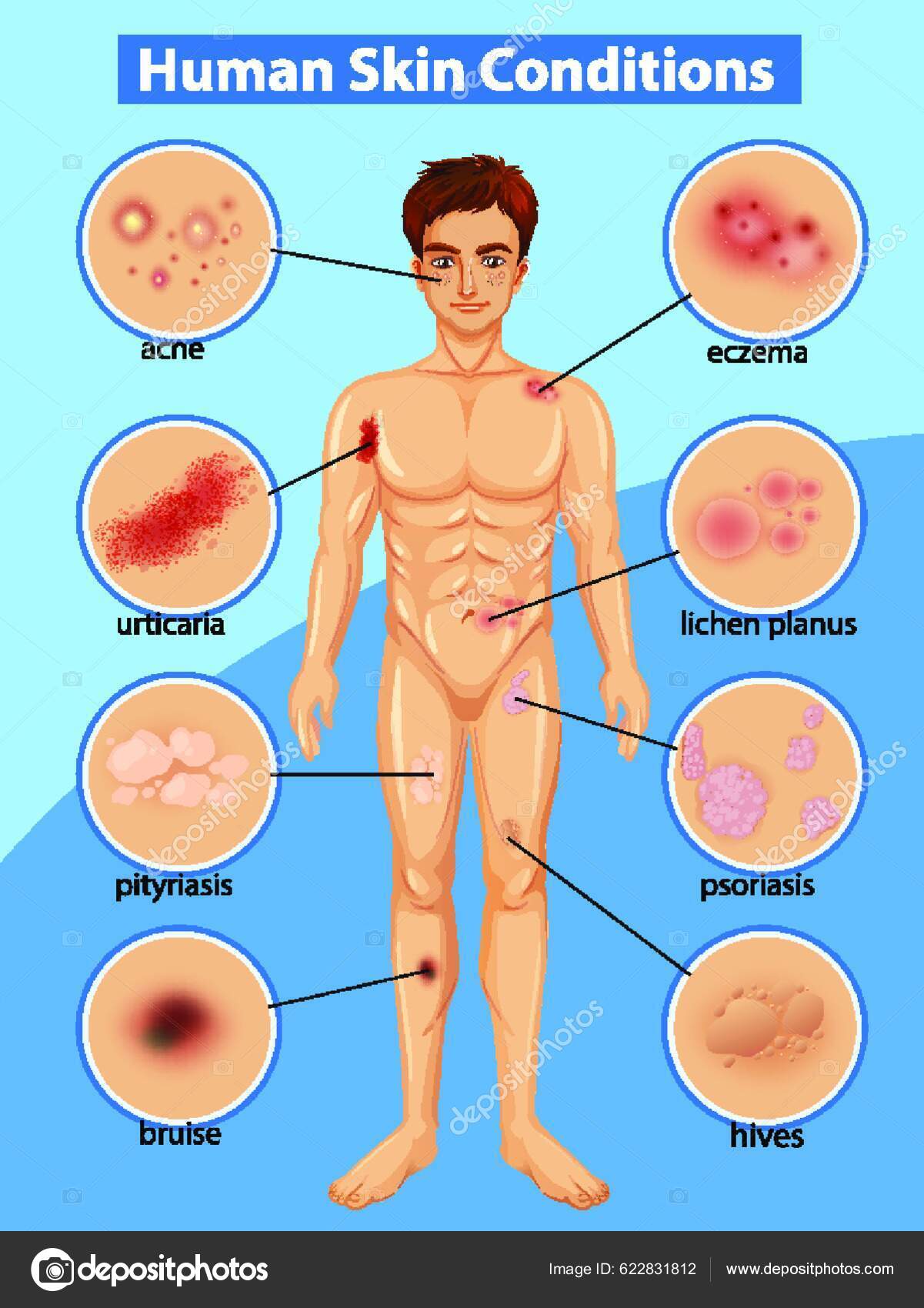 Diagram Showing Differen Human Skin Conditions Stock Vector by ©YAY