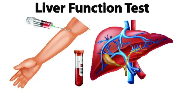 Set Liver Function Test Education — Stock Vector