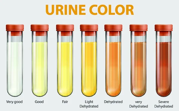 Ilustração Cartela Cores Urina — Vetor de Stock