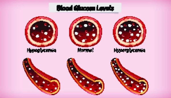 Medical Blood Glucose Level — 스톡 벡터
