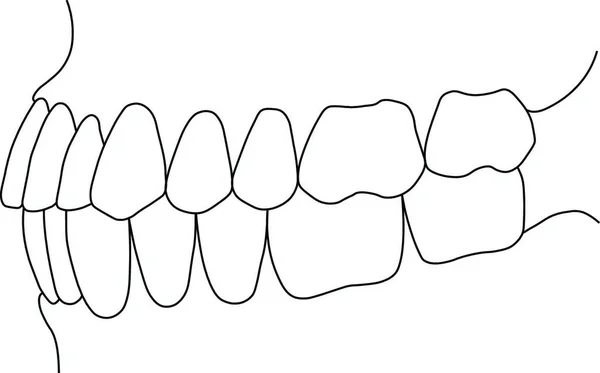 Dentária Mordida Dentes Vetor Ilustração —  Vetores de Stock