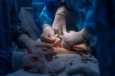 Bir grup cerrah bir hastaya ameliyat yapıyor. Cerrahlar görevlerine odaklandığı için sahne yoğun ve ciddi. Hasta masanın üzerinde yatıyor.