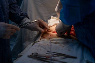 Bir cerrah bir hastanın midesini kesiyor. Sahne karanlık ve yoğun, cerrah eldiven takıyor ve elinde bir makas tutuyor. Hasta büyük ihtimalle büyük bir ameliyat geçiriyor.