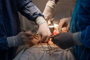 Bir grup cerrah bir hastaya ameliyat yapıyor. Cerrahlar görevlerine odaklandığı için sahne yoğun ve ciddi. Hasta masanın üzerinde yatıyor.