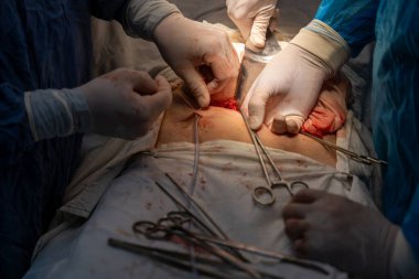 Bir grup cerrah bir hastaya ameliyat yapıyor. Cerrahlar görevlerine odaklandığı için sahne yoğun ve ciddi. Hasta masanın üzerinde yatıyor.