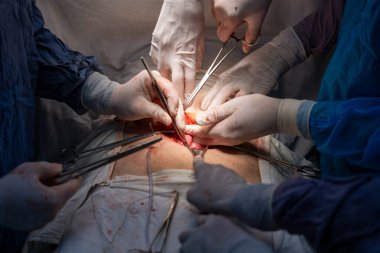 Bir grup cerrah bir hastaya ameliyat yapıyor. Cerrahlar görevlerine odaklandığı için sahne yoğun ve ciddi. Hasta masanın üzerinde yatıyor.